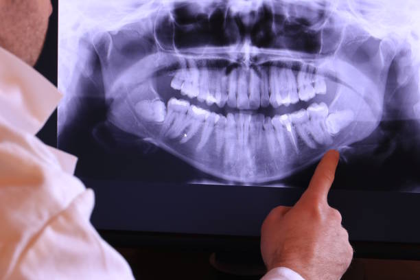 Best Emergency Treatment for Dental Infections or Abscesses in Auburn, KY
